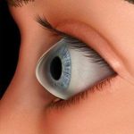 Keratoconus photo