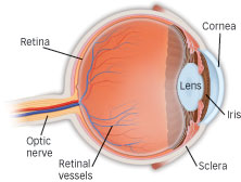 Retinal detachment - eye, scheme 1
