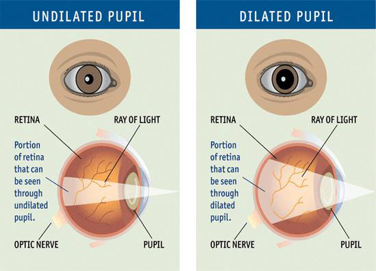 cause of blown pupil