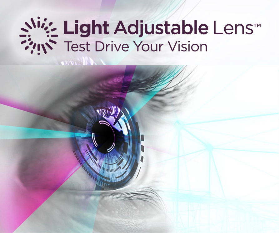 light adjustable lens eye